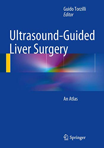 Ultrasound-Guided Liver Surgery: An Atlas von Springer