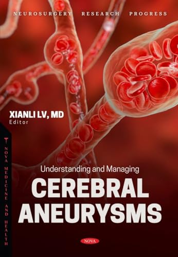 Understanding and Managing Cerebral Aneurysms (Neurosurgery Research Progress) von Nova Medicine and Health