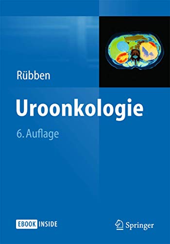 Uroonkologie Uroonkologie