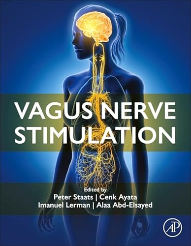 Vagus Nerve Stimulation Vagus Nerve Stimulation von Academic Press