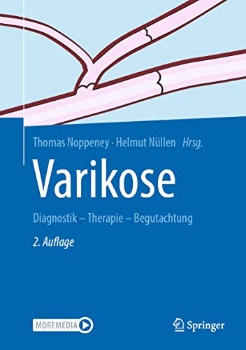 Varikose: Diagnostik - Therapie - Begutachtung Varikose: Diagnostik - Therapie - Begutachtung
