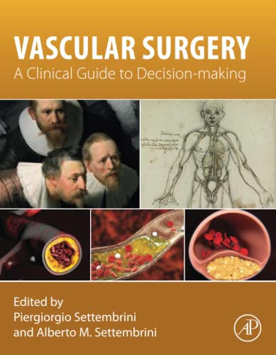 Vascular Surgery: A Clinical Guide to Decision-making von Academic Press