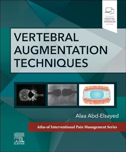 Vertebral Augmentation Techniques (Atlas of Interventional Pain Management) von Elsevier