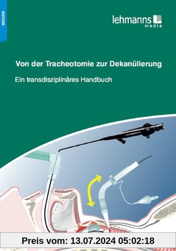 Von der Tracheotomie zur Dekanülierung: Ein transdisziplinäres Handbuch