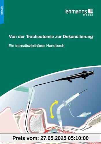 Von der Tracheotomie zur Dekanülierung: Ein transdisziplinäres Handbuch