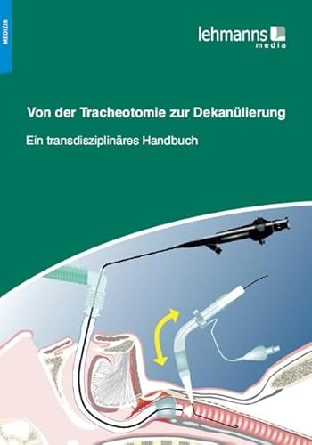 Von der Tracheotomie zur Dekanülierung: Ein transdisziplinäres Handbuch