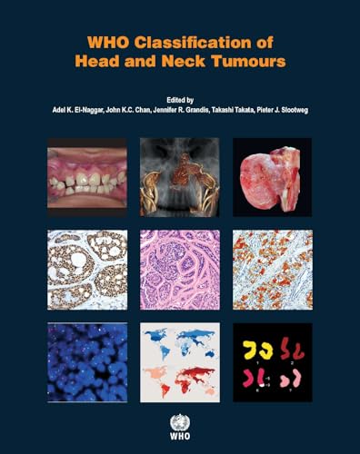 WHO Classification of Head and Neck Tumours (World Health Organization Classification of Tumours)