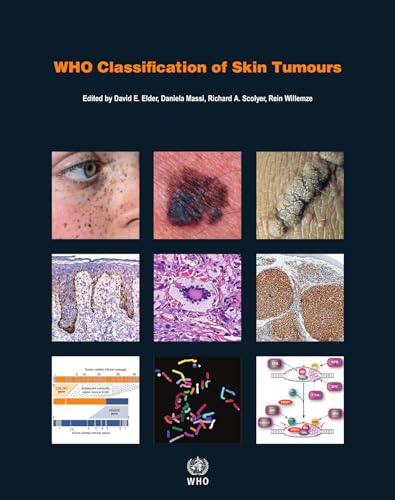 Who Classification of Skin Tumours: WHO Classification of Tumours, Volume 11 (Who Classification of Tumours: International Agency for Research on Cancer, Band 11)
