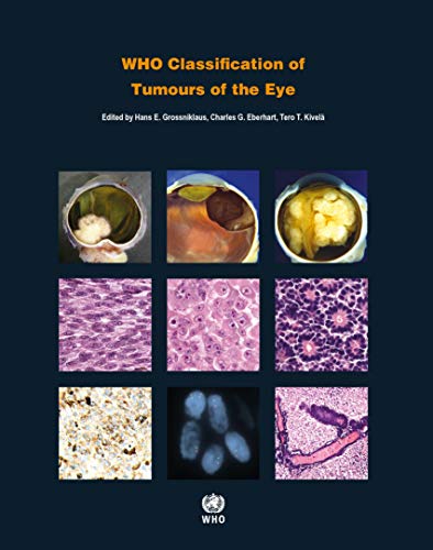 Who Classification of Tumours of the Eye: WHO Classification of Tumours, Volume 12 (World Health Organization Classification of Tumours)