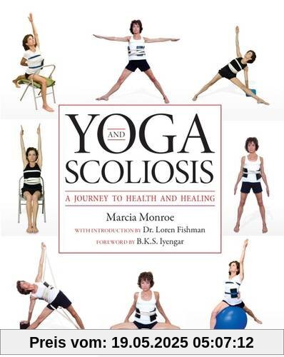 Yoga and Scoliosis: A Journey to Health and Healing