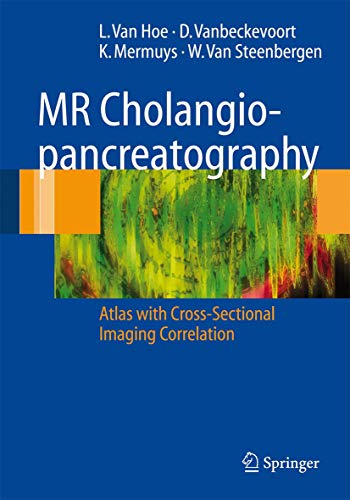 MR Cholangiopancreatography: Atlas with Cross-Sectional Imaging Correlation MR Cholangiopancreatography: Atlas with Cross-Sectional Imaging Correlation