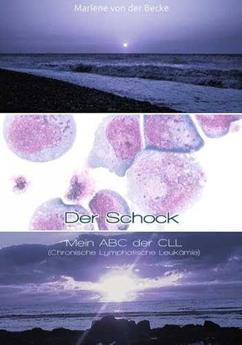 Der Schock: Mein ABC der CLL (Chronische Lymphatische Leukämie) von epubli GmbH